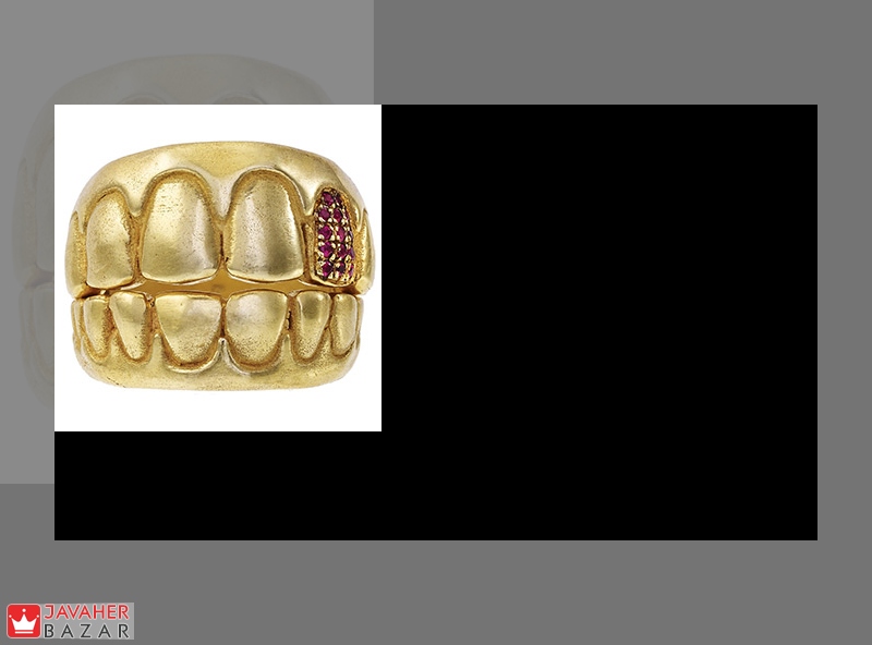 مزایا و معایب استفاده از طلا در دندانپزشکی مزایا و معایب استفاده از طلا در دندانپزشکی