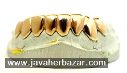 مزایا و معایب استفاده از طلا در دندانپزشکی مزایا و معایب استفاده از طلا در دندانپزشکی
