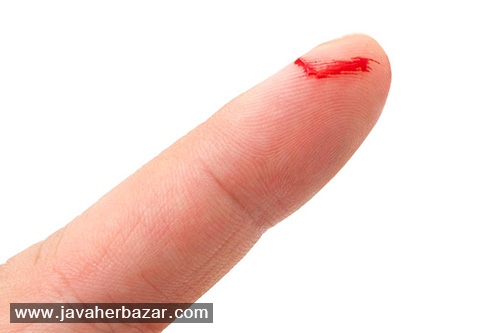 آیا تغذیه در روند بهبود زخم تاثیر گذار است؟ آیا تغذیه در روند بهبود زخم تاثیر گذار است؟