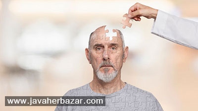 تشخیص آلزایمر از روی چشم تشخیص آلزایمر از روی چشم