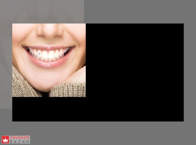 استفاده از سنگ های قیمتی در دندان مایاها استفاده از سنگ های قیمتی در دندان مایاها